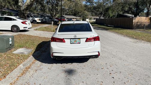Photo 1 of 6 of 2018 Acura TLX V6 Advance